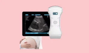 B2B Ultrasound Probe 3 in 1